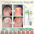 Flyles™Nail Repair Treatment Gel